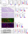 Alpelisib improves kidney lesions in MRL-lpr lupus nephritis models.