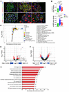 Spatial transcriptomic changes observed in glomeruli from patients with cla