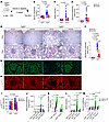 Alpelisib improves kidney lesions in an accelerated mouse model of collapsi