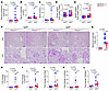 PIK3CA deletion in podocytes improves kidney lesions in an accelerated mous