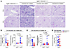 PIK3CA deletion in podocytes up to the age of 6 weeks is able to reverse ki