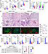 Alpelisib improves kidney lesions in NZBWF1/J lupus nephritis models.