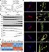 Mgp-deleted cerebral ECs acquire mesenchymal markers.