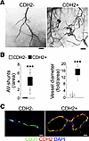 Mgp-deleted cerebral ECs acquire mesenchymal markers and cause vascular mal