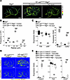 Limiting HDAC2 prevents cerebral ECs from undergoing mesenchymal differenti