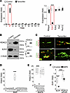 Alterations in the expression of HDAC2 and EZH1 in cerebral ECs after Mgp d