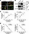 Alterations in HDAC2 and EZH1 in human cerebral AVMs correlate with the ind