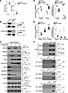 Alterations in HDAC2 and EZH1 cause changes in H4K8ac and H3K27me3 in the r