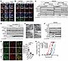 SHP2-AIs repress autophagy independent of SHP2.