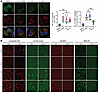 SHP2-AIs repress autophagy through impairing lysosome function.