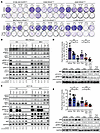 MEK/SHP2/autophagy triple inhibition is highly effective in KRAS-mutated ca