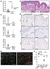 Human skin TRM may be sufficient to mediate MDE.