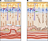 The retina in AMD.