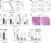 IL-21R signaling is required for neuropathy development in NOD.AireGW/ mice