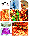 Uncontrolled VEGF production promotes abnormal vascular growth in muscle. (