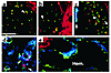 Phenotypically different mural cells are associated with vessels induced by