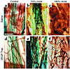 Normal capillaries induced by low VEGF levels are resistant to VEGF depriva