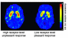 Images of axial sections obtained with PET to measure the numbers of DA D2