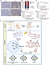 High expression of HO-1 correlates with unfavorable RT prognosis.