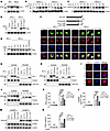 RT induces HO-1 and promotes its cleavage.