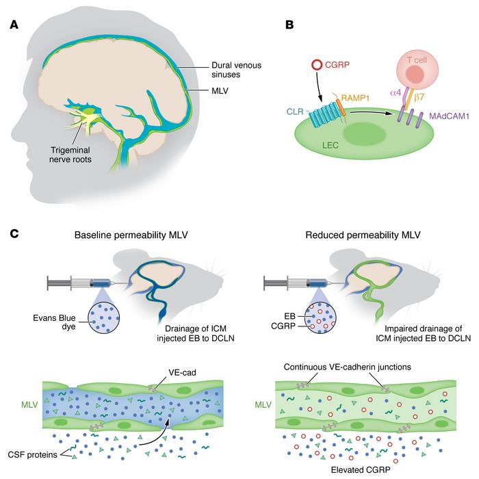 CGRP signaling mediates the functional interplay between MLVs and migrai...