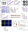 Tumor-suppressive function of RPL14 in NPC.