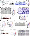 SELE-S149R mutation in endothelial cells promotes the tumorigenesis and met