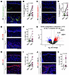 Calcipotriol-plus–5-FU treatment causes toxic autophagy and apoptosis assoc