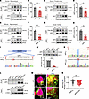 Reduced expression level of APP lactylation modification in AD.