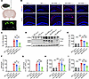 APP-K612la reduced Aβ generation in vivo.