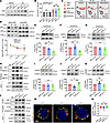 APP-K612la promoted the endosomal-lysosomal degradation process via CD2AP.