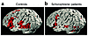 Generic brain-activation maps for (a) control group and (b) patients with s