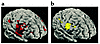 Rendered images of the brain showing regions of increased activity followin