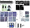 Osteopetrotic phenotype of TRAP-DN–c-Jun TG mice. (A) Expression of DN–c-Ju