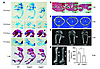 Skeletal defects in caspase-3–deficient mice. (A) Alizarin red and alcian b