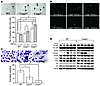 TGF-β–associated replicative senescence of caspase-3–deficient BMSSCs. (A)