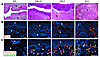 Stages of cervical carcinogenesis and angiogenic profile of HPV/E2 mice. (A