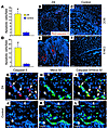 ZA induces apoptosis in epithelial cells and ECs in tumors and CIN-3 lesion