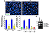 ZA inhibits MMP-9 expression and activation in macrophages. (A) Reduced MMP