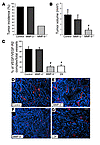 ZA inhibits the formation of VEGF/VEGF-R2 complexes on the neoplastic vascu