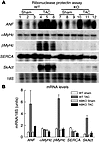 Fetal gene induction after TAC.