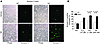 Apoptosis in cultured myocytes.