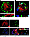 SLE-ICs associate with TLR9 and CD32. U373 cells coexpressing YFP-tagged TL