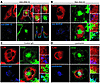 CD32 delivers anti-DNA ICs to TLR9-containing lysosomes. U373 cells coexpre