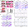 IL-1β– and VEGF-induced angiogenesis and inflammatory cell infiltration in