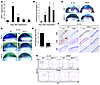 The role of MCP-1 in IL-1β– or VEGF-induced angiogenesis. (A) Kinetics of M