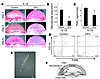 Expression of COX-2 in infiltrating macrophages during IL-1β–induced angiog