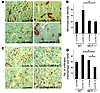 Enhancement of angiogenesis and macrophage infiltration by LLC/IL-1β was in