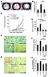 The effect of a COX-2 inhibitor on IL-1β–induced tumor angiogenesis. (A) Re