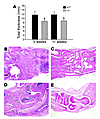 Spontaneous K/BxN arthritis. Nik–/– mice and control littermates were bred